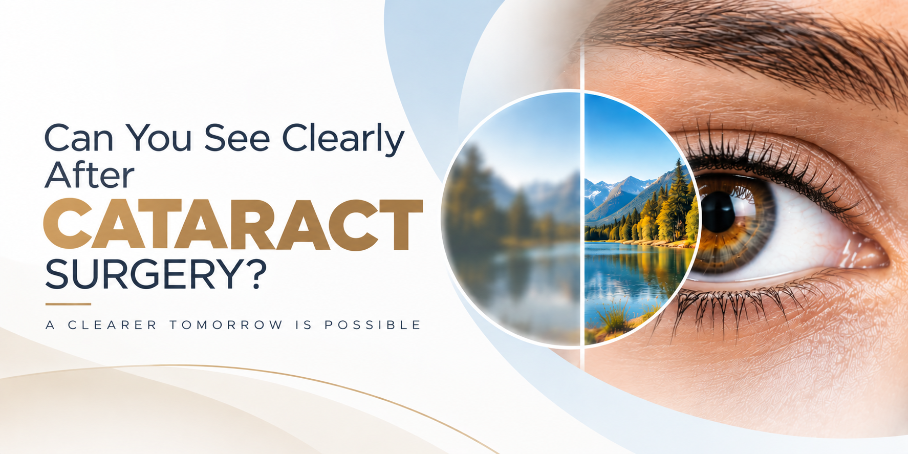 Clear vision after cataract surgery without glasses