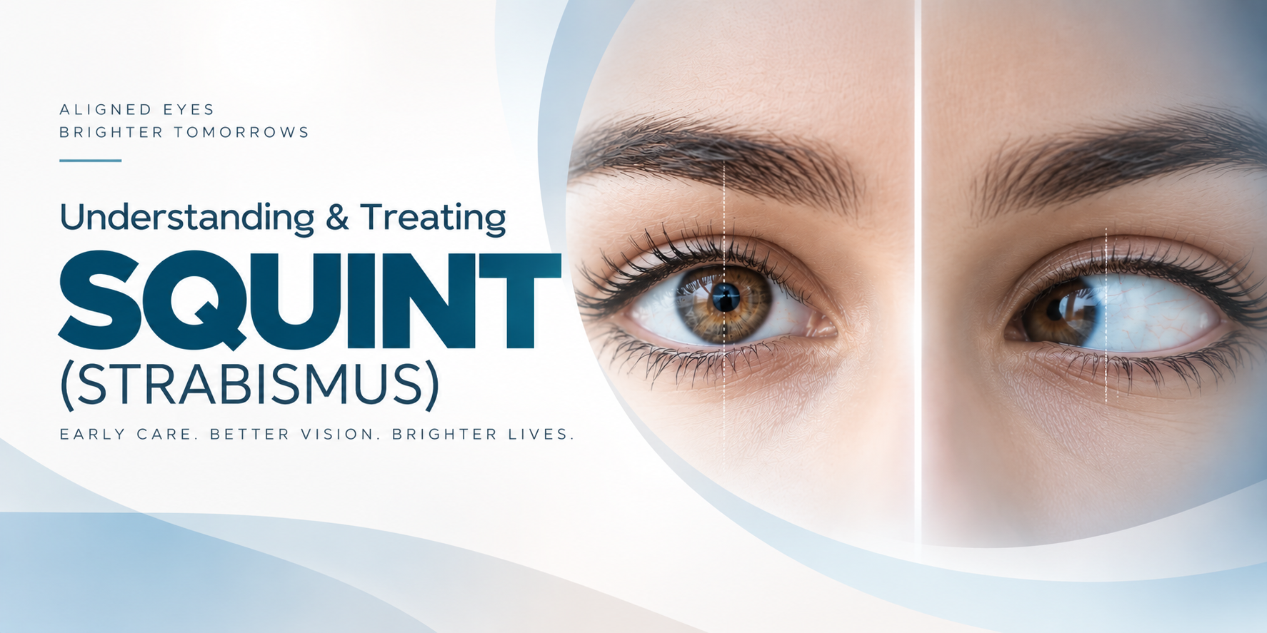 Squint (Strabismus) treatment and eye alignment