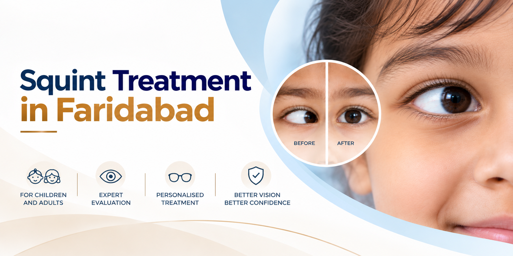 Squint Treatment in Faridabad at Drishti Eye Centre